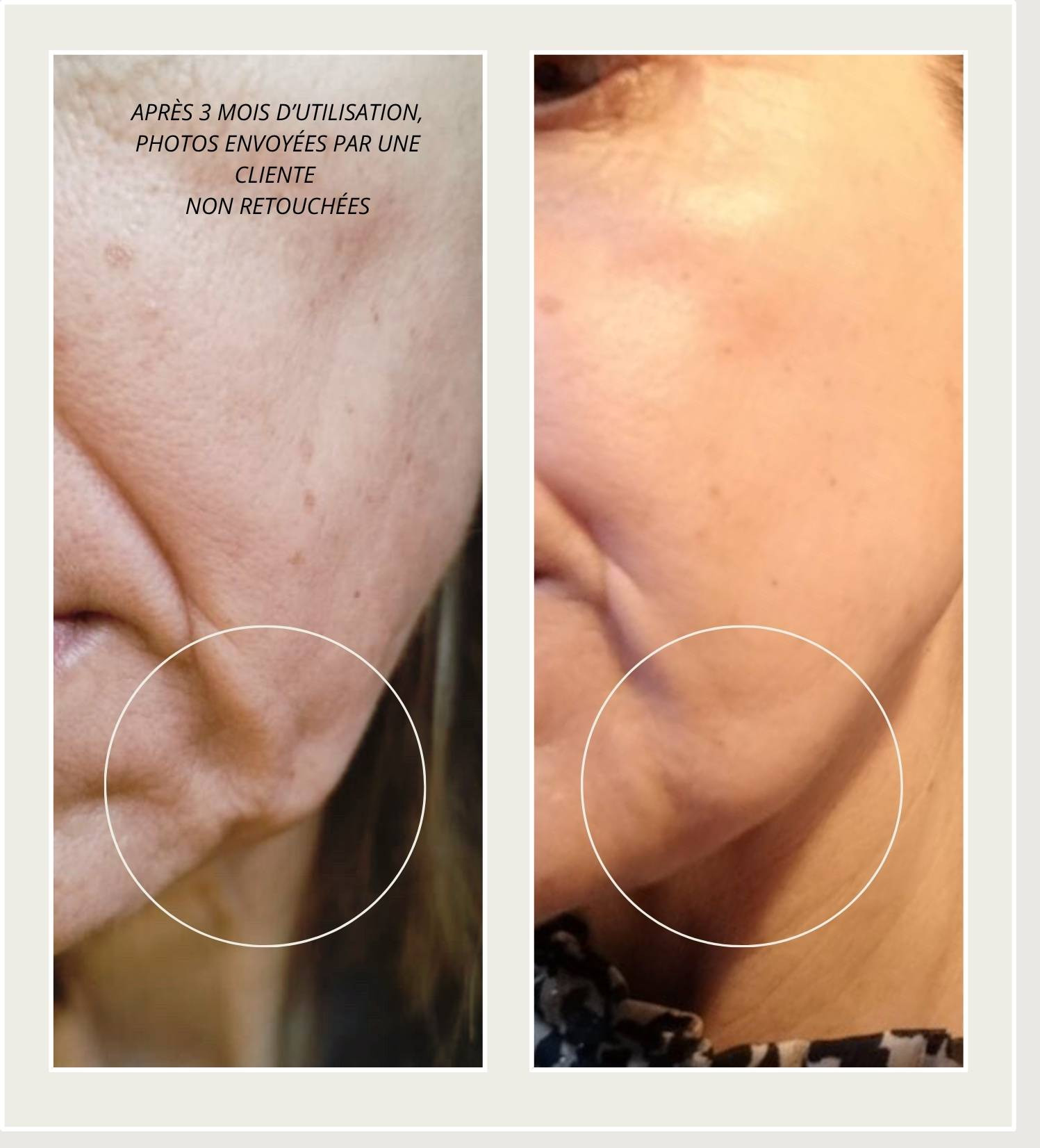 duo fermeté anti-âge peptides matrixyl syn ake