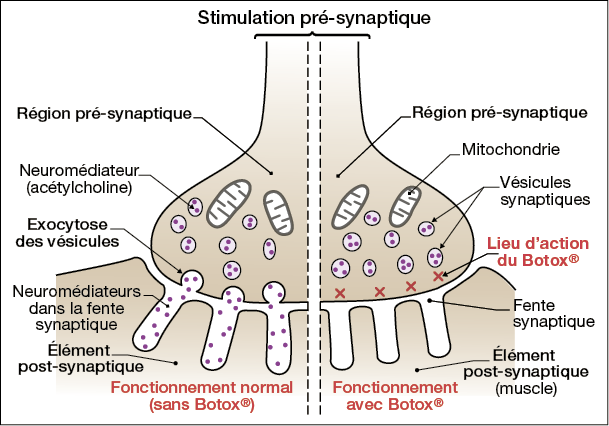 effet botox mécanisme d'action